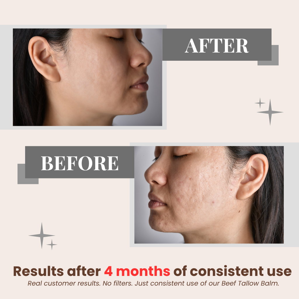 WoodSleep™ Whipped Tallow Honey Balm